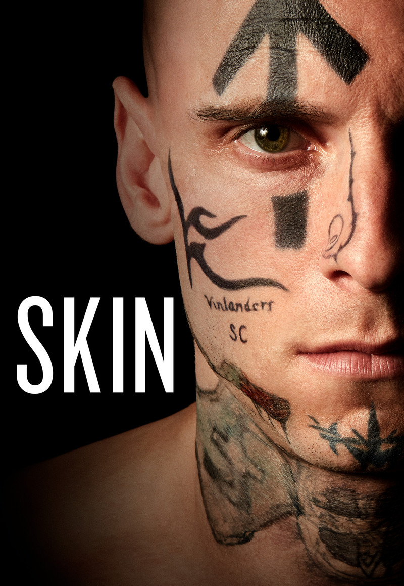 Skin - Poster
